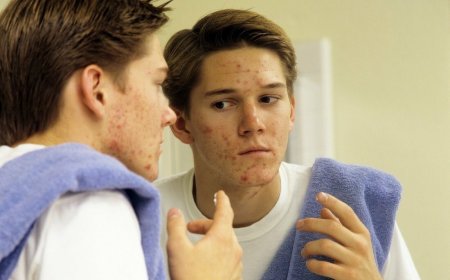 „Ја сам наказа“ (незадовољство изгледом)