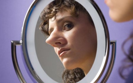 Теодорин случај: дисморфофобија